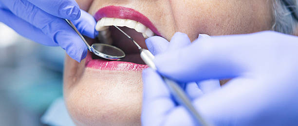 Best Cracked Tooth Emergency Dentist  in Riverdale, GA